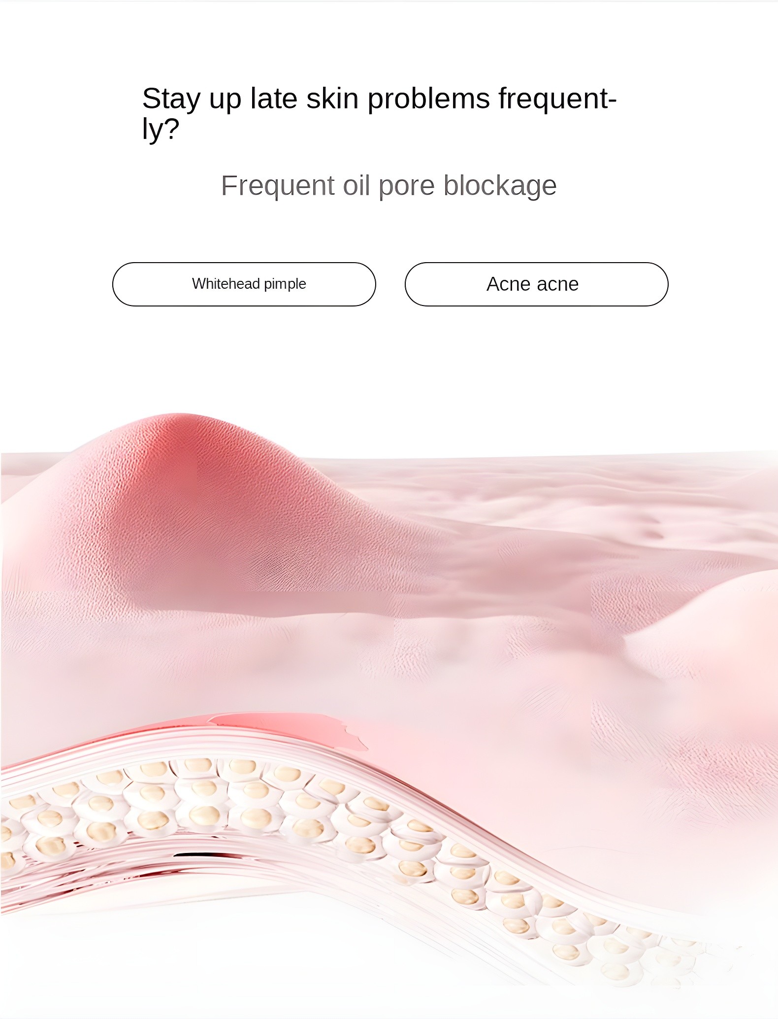 Skin cross-section showing pore blockage